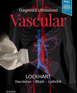 Diagnostic Ultrasound: Vascular - eBook PDF