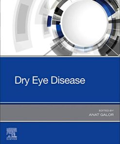 Dry Eye Disease 1st Edition - eBook PDF