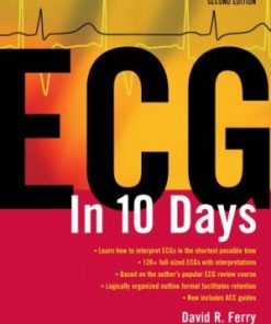 ECG in 10 Days 2nd Edition David Ferry - eBook PDF
