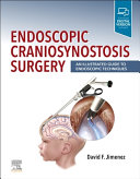 Endoscopic Craniosynostosis Surgery: An Illustrated Guide to Endoscopic Techniques 1st edition - eBook PDF