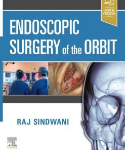 Endoscopic Surgery of the Orbit 1st Edition Raj Sindwani - eBook PDF