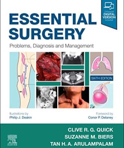 Essential Surgery-Problems, Diagnosis and Management, 6e (Feb 19, 2020)_(0702076317)_(Elsevier) 6th Edition Clive R. G. Quick - eBook PDF