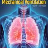 Essentials of Mechanical Ventilation 4th Edition Edition Dean R. Hess - eBook PDF
