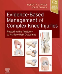 Evidence-Based Management of Complex Knee Injuries: Restoring the Anatomy to Achieve Best Outcomes - eBook PDF