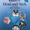 EXPERTDDX : Head and Neck. - eBook PDF