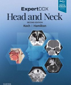 EXPERTDDX : Head and Neck. - eBook PDF