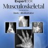 ExpertDDx: Musculoskeletal 2nd Edition Kirkland W. Davis - eBook PDF