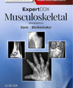 ExpertDDx: Musculoskeletal 2nd Edition Kirkland W. Davis - eBook PDF