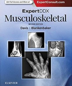 ExpertDDX: Musculoskeletal 2nd Edition Kirkland W. Davis - eBook PDF