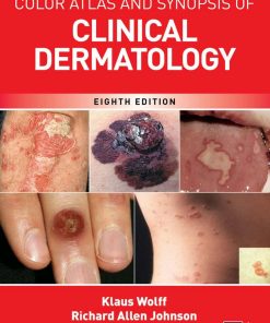 Fitzpatrick's Color Atlas and Synopsis of Clinical Dermatology, 8th Edition Klaus Wolff - eBook PDF