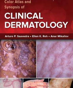 Fitzpatrick's Color Atlas and Synopsis of Clinical Dermatology, Ninth Edition Saavedra - eBook PDF