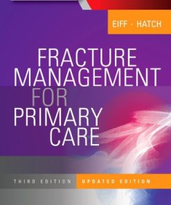 Fracture Management for Primary Care Updated Edition M. Patrice Eiff - eBook PDF