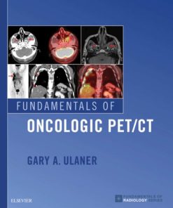 Fundamentals of Oncologic PET/CT 1st Edition Gary Ulaner - eBook PDF