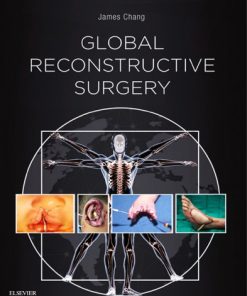 Global Reconstructive Surgery 1st Edition - eBook PDF