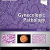 Gynecologic Pathology 2nd Edition Nucci Marisa R. - eBook PDF
