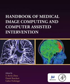 Handbook of medical image computing and computer assisted intervention 1st Edition- eBook PDF