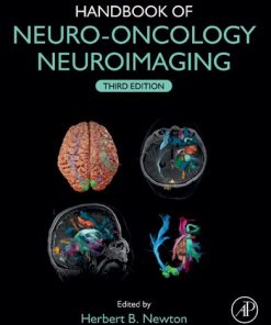 Handbook of Neuro-Oncology Neuroimaging 3rd Edition Herbert B. Newton - eBook PDF