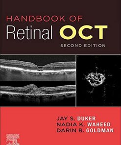 Handbook of Retinal OCT: Optical Coherence Tomography E-Book 2 Edition Edition Jay S. Duker - eBook PDF