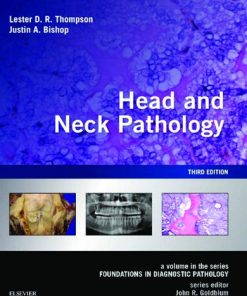 Head and Neck Pathology, A Volume in the Series: Foundations in Diagnostic Pathology, 3ED 3rd Edition Thompson - eBook PDF