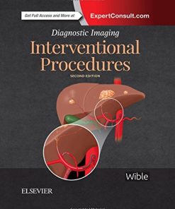 Interventional Procedures 2nd Edition Brandt C. Wible - eBook PDF