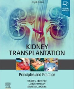 Kidney Transplantation: Principles and Practice 8th Edition Edition Stuart Knechtle - eBook PDF