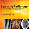 Learning radiology: recognizing the basics 3rd edition Edition Herring - eBook PDF