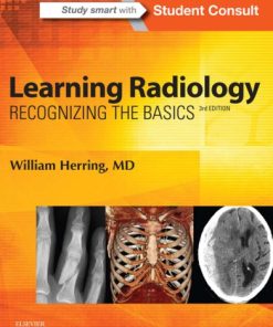 Learning radiology: recognizing the basics 3rd edition Edition Herring - eBook PDF