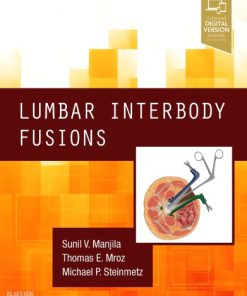 Lumbar Interbody Fusions 1st Edition Edition Sunil Manjila - eBook PDF