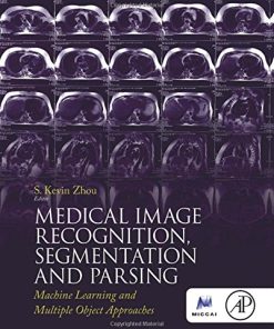 Medical image recognition, segmentation and parsing : machine learning and multiple object approaches 1st Edition Zhou - eBook PDF