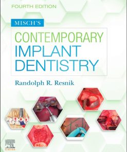 Misch's Contemporary Implant Dentistry 4th Edition - eBook PDF