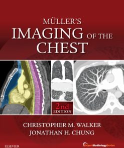 Muller’s Imaging of the Chest 2nd Edition Christopher Walker - eBook PDF