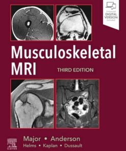 Musculoskeletal MRI 3rd Edition Nancy Major - eBook PDF