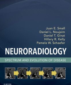 Neuroradiology: Spectrum and Evolution of Disease 1st Edition Edition Juan Small - eBook PDF