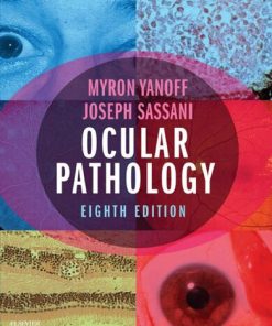 Ocular Pathology 8th Edition M.D. Yanoff - eBook PDF