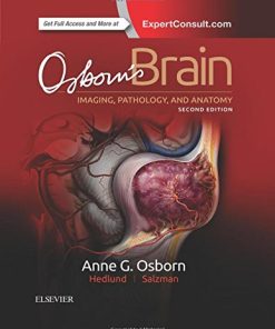 Osborn’s Brain: imaging, pathology, and anatomy 2nd Edition Anne G. Osborn - eBook PDF