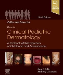 Paller and Mancini - Hurwitz Clinical Pediatric Dermatology: A Textbook of Skin Disorders of Childhood & Adolescence 6th Edition Amy S. Paller - eBook PDF