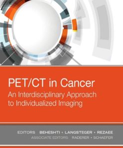 PET-CT in Cancer An Interdisciplinary Approach to Individualized Imaging 1st edition - eBook PDF