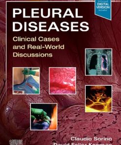 Pleural Diseases: Clinical Cases and Real-World Discussions 1st Edition Claudio Sorino - eBook PDF