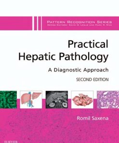 Practical Hepatic Pathology: A Diagnostic Approach 2nd Edition Romil Saxena - eBook PDF