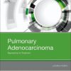 Pulmonary Adenocarcinoma: Approaches to Treatment, 1e - eBook PDF