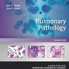 Pulmonary Pathology 2nd Edition Dani S. Zander - eBook PDF