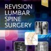 Revision Lumbar Spine Surgery 1st Edition Robert F. Heary - eBook PDF