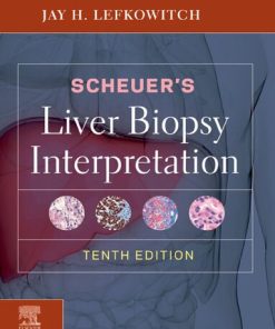 Scheuer's Liver Biopsy Interpretation 10th Edition Jay H. Lefkowitch Md - eBook PDF