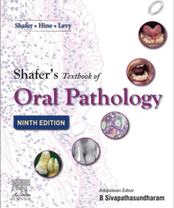 Shafer's Textbook of Oral Pathology 9th Edition William G Shafer - eBook PDF
