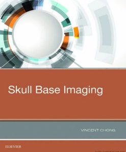 Skull Base Imaging 1st Edition Vincent Fook-Hin Chong - eBook PDF