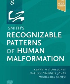 Smith's Recognizable Patterns of Human Malformation 8th Edition Kenneth Lyons Jones Md - eBook PDF
