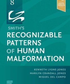 Smith's Recognizable Patterns of Human Malformation 8th Edition Kenneth Lyons Jones - eBook PDF
