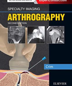 Specialty Imaging: Arthrography 2nd Edition Julia Crim Md - eBook PDF