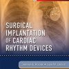 Surgical Implantation of Cardiac Rhythm Devices 1st Edition Jeanne Poole - eBook PDF