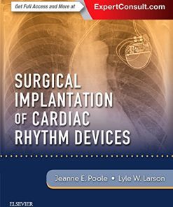 Surgical Implantation of Cardiac Rhythm Devices 1st Edition Jeanne Poole - eBook PDF